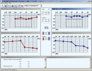 Software de audiometría Sibelmed W-50