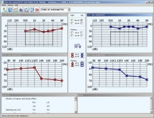 Software de audiometría Sibelmed W-50